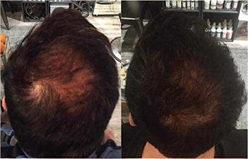 Zenagen Revolve Thickening Hair Loss Treatment for Men (7497783378158)