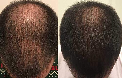 Zenagen Revolve Thickening Hair Loss Treatment for Men (7497783378158)